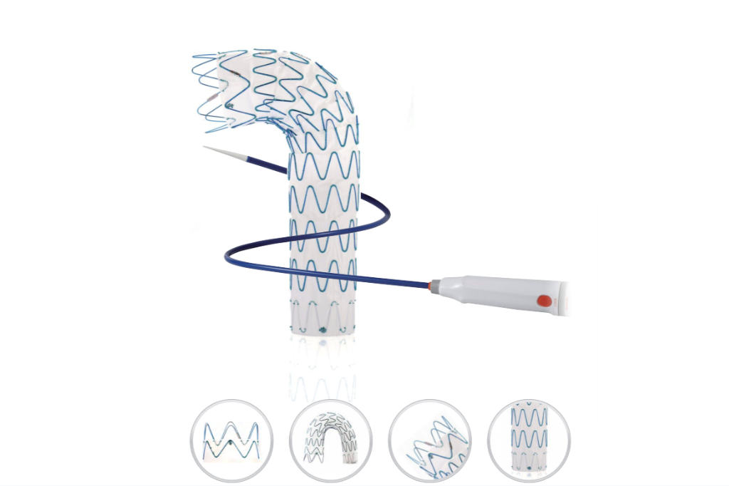 Thoracic Aortic Stent Graft System Rankings and Reviews